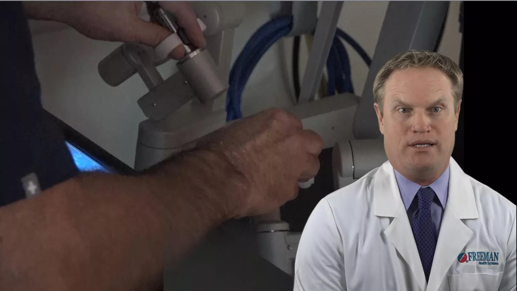 Dr. Anderson on Robotic Surgery Dr. Anderson on Robotic Surgery