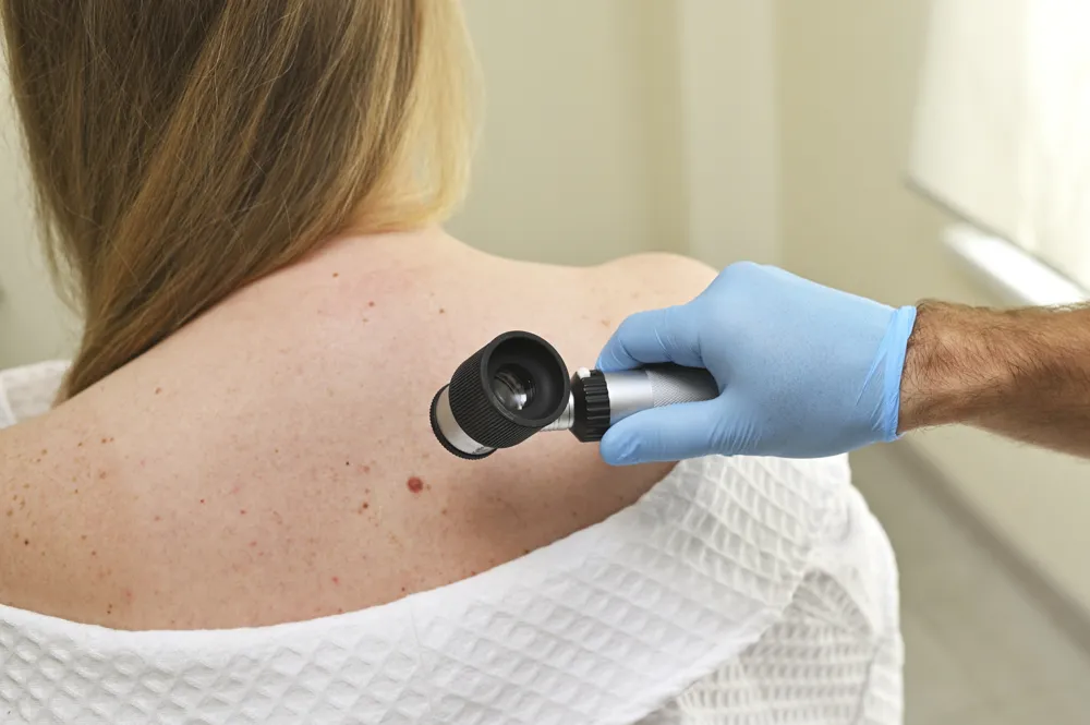 Dermatology